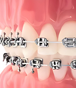 Hi-Smiles Essentials